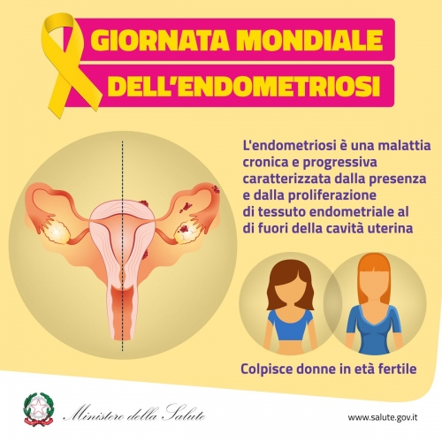 endometriosi 1