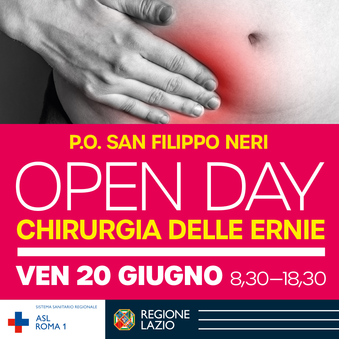 20 giugno Open Day Chirurgia delle Ernie al P.O. San Filippo Neri